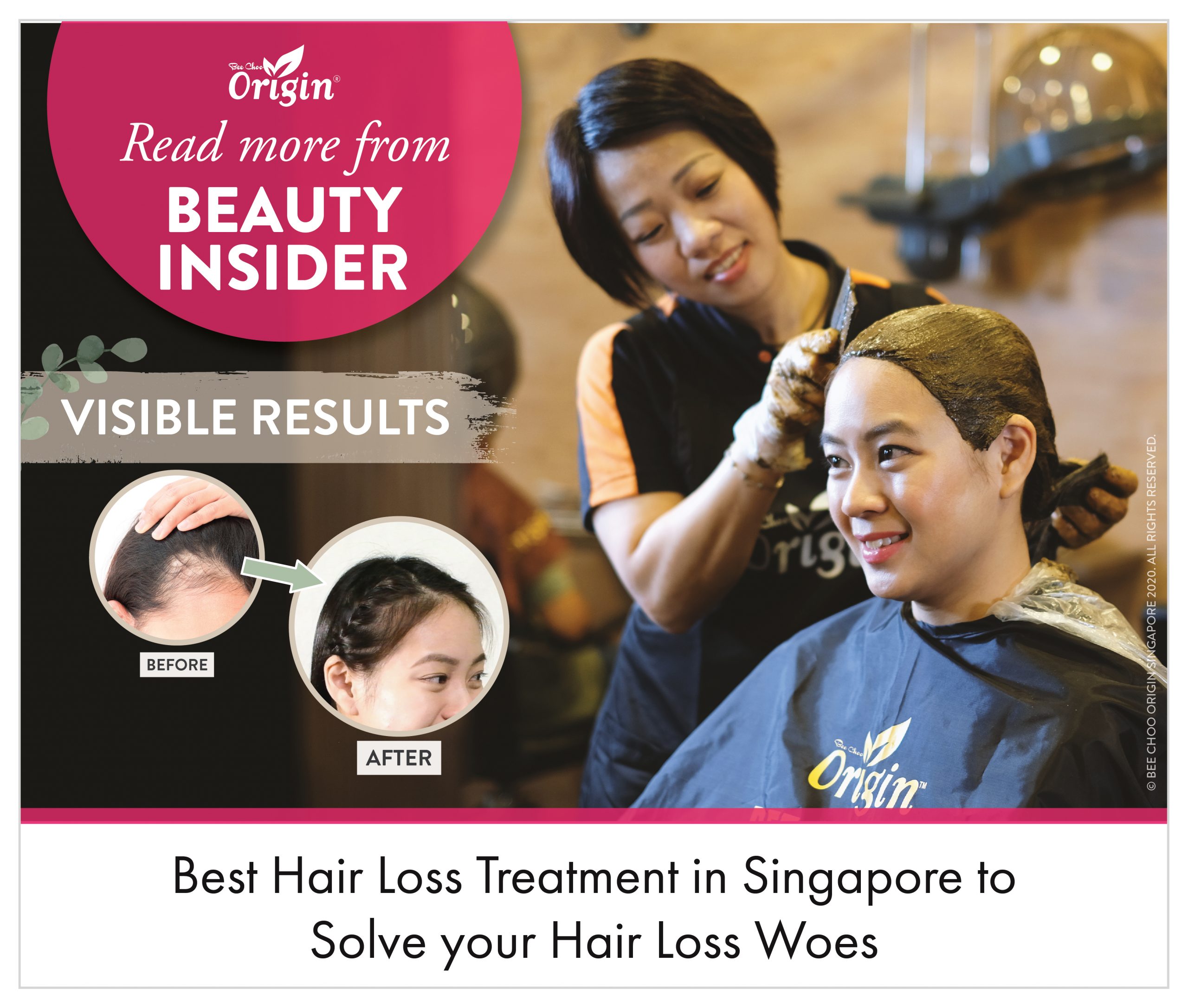 15 Best Hair Loss Treatments in Singapore | Bee Choo Origin
