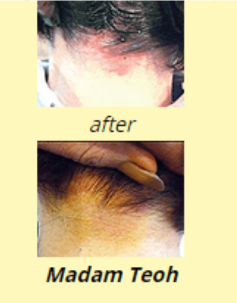 White Hair Treatment Madam Teoh - Bee Choo Origin Malaysia