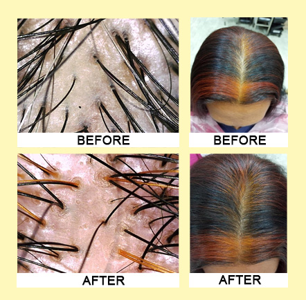 Testimonials Hair Loss Treatment - Bee Choo Origin Malaysia